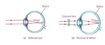 Axon