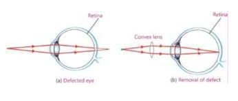 Axon